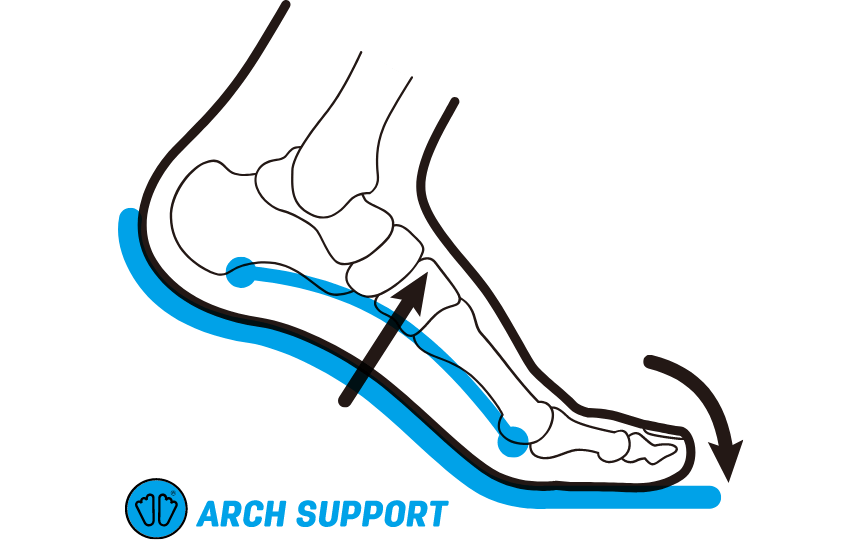 ARCH SUPPORT