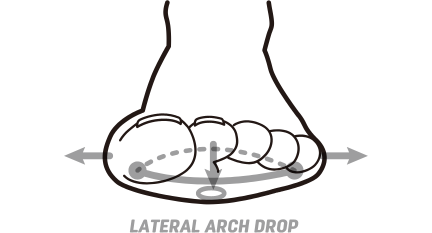 LATERAL ARCH DROP